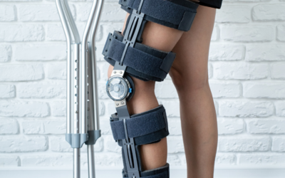 Rehab Timelines vs. Milestones: What Really Gets You Back in the Game
